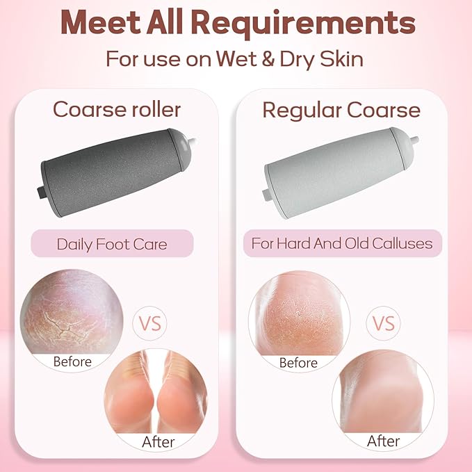 Electronic Cordless Pedicure Callus Dead Skin Remover Polishing Tool