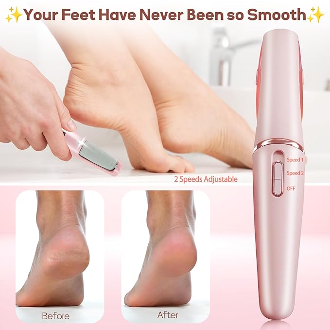 Electronic Cordless Pedicure Callus Dead Skin Remover Polishing Tool
