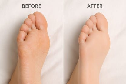 Electronic Cordless Pedicure Callus Dead Skin Remover Polishing Tool