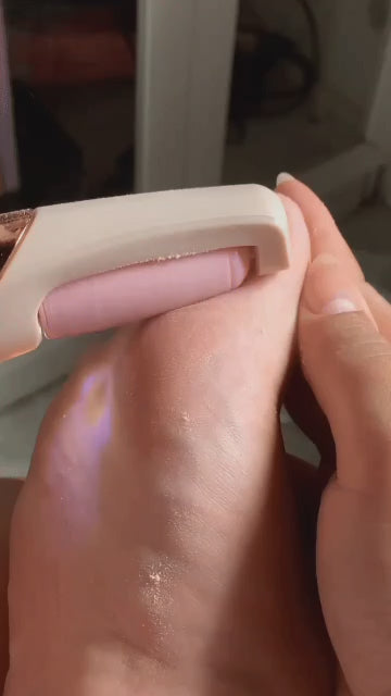 Electronic Cordless Pedicure Callus Dead Skin Remover Polishing Tool